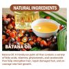 EELHOE Batana Oil Conditioner Moisturizes, Hydrates, Improves Dry Hair, Softens And Fluffs Hair Care